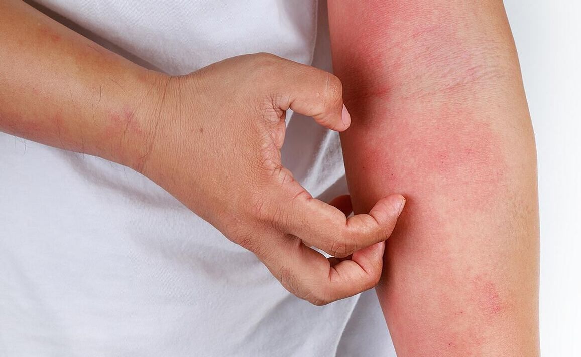 možni zapleti pri uporabi sode